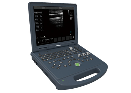 DW-PE522,全數字彩色多普勒超聲診斷儀,推車式彩超